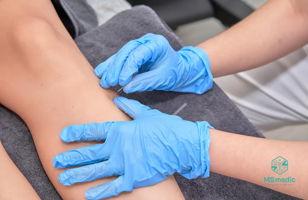 วิธีรักษากล้ามเนื้ออักเสบโดยไม่นวด