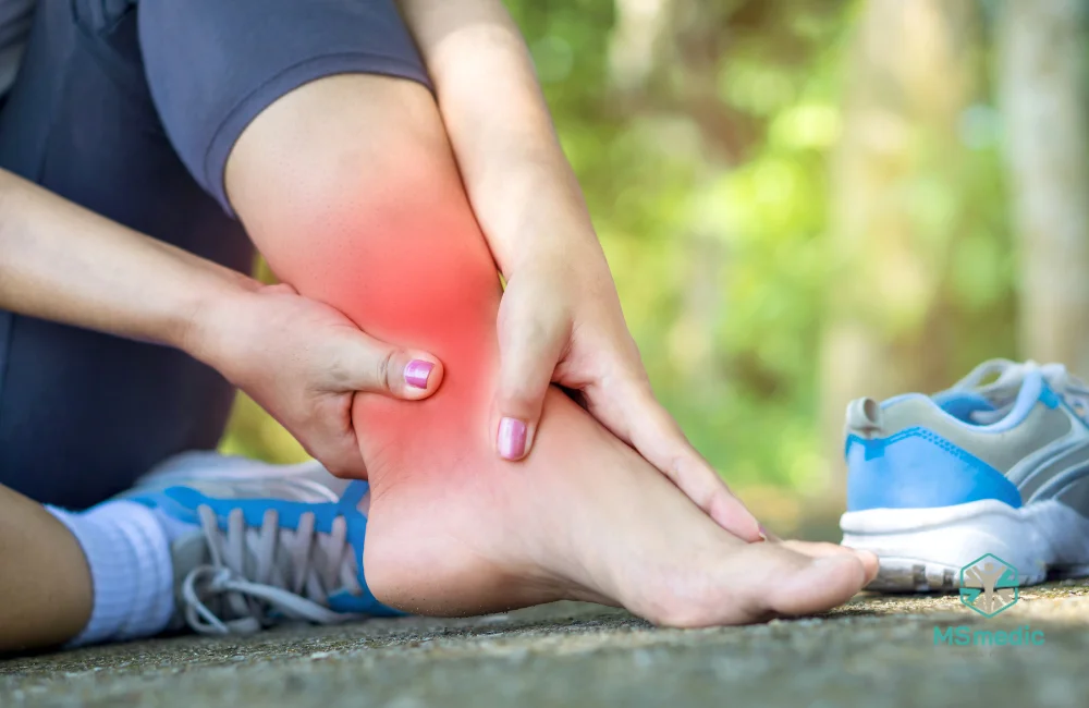 Muscle Sprain vs Strain คือ