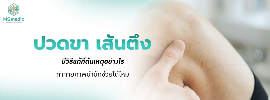 ปวดขา เส้นตึง มีวิธีแก้ที่ต้นเหตุอย่างไร