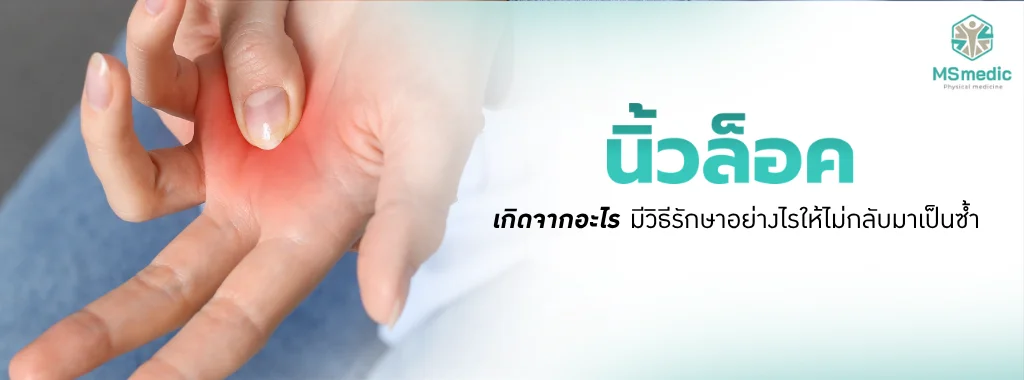 นิ้วล็อค เกิดจากอะไร มีวิธีรักษาอย่างไรให้ไม่กลับมาเป็นซ้ำ