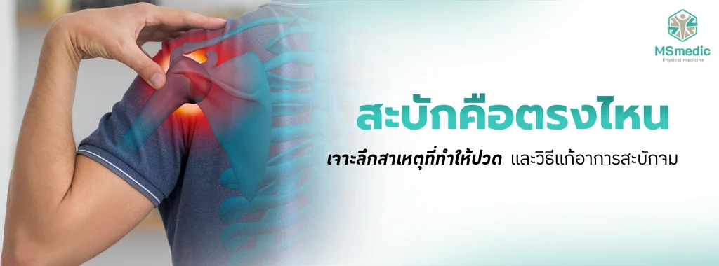 สะบัก คือตรงไหน เจาะลึกสาเหตุที่ทำให้ปวด และวิธีแก้อาการสะบักจม