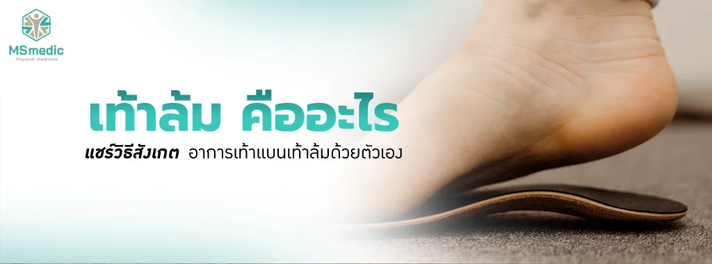 เท้าล้ม คืออะไร แชร์วิธีสังเกตอาการเท้าแบนเท้าล้มด้วยตัวเอง
